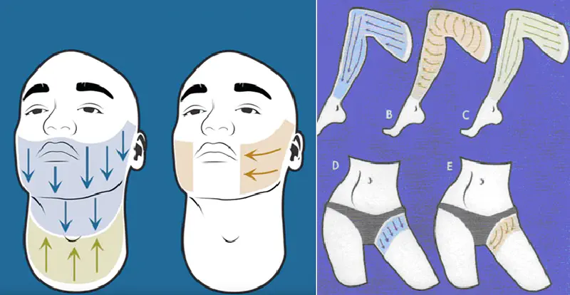 Three diagrams showing common shave patterns for face, neck, legs, groin regions of the human body